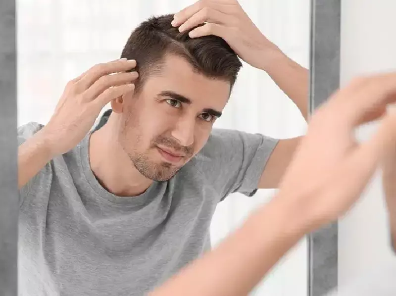 Follow These 8 Tips To Prevent Your Scalp From Balding